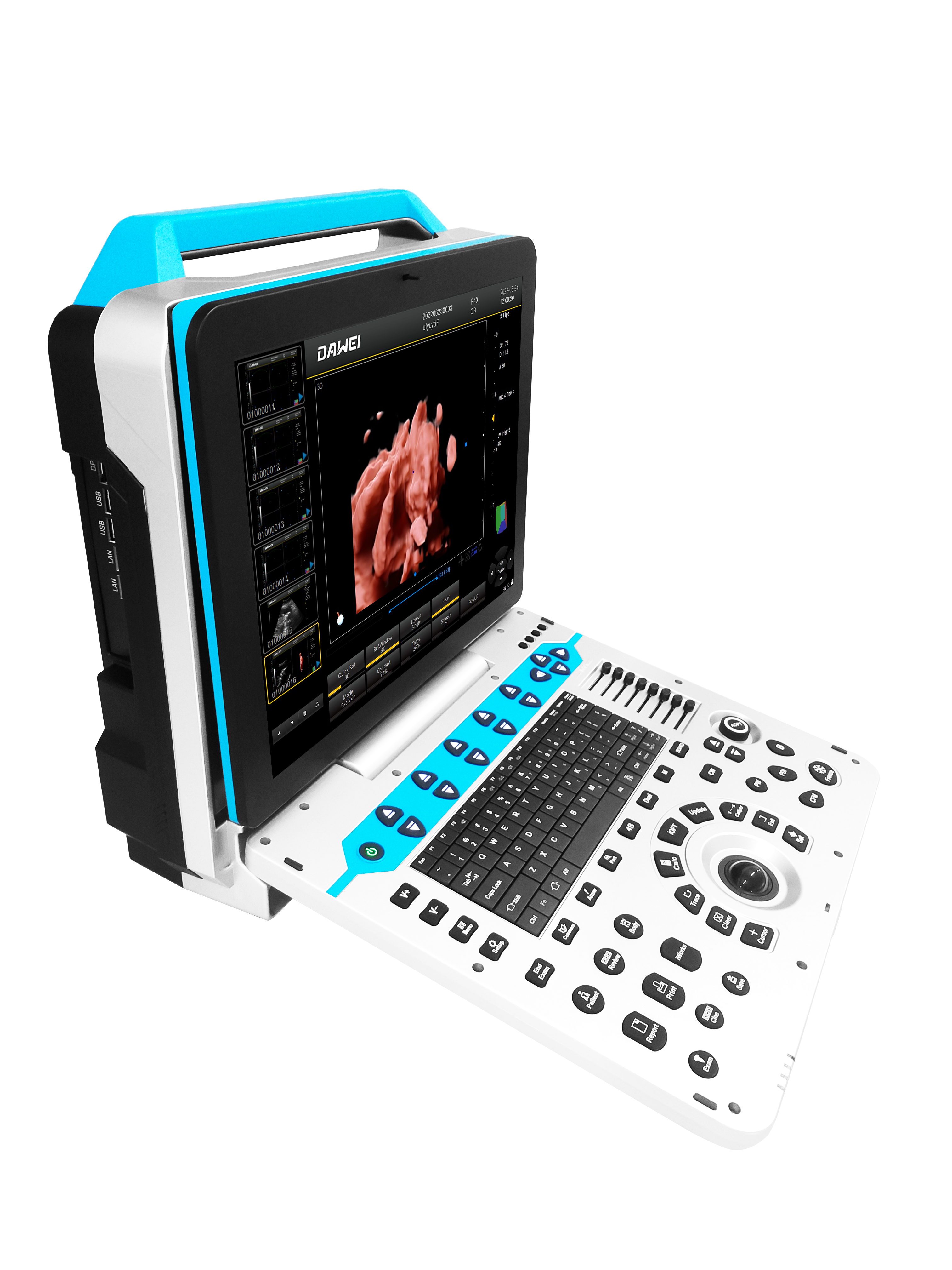 DAWEI ULTRASOUND DW-P3